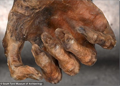 Main d'Otzi